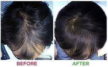 ReGrow 7 Day Ginger Germinal Hair Growth Serum